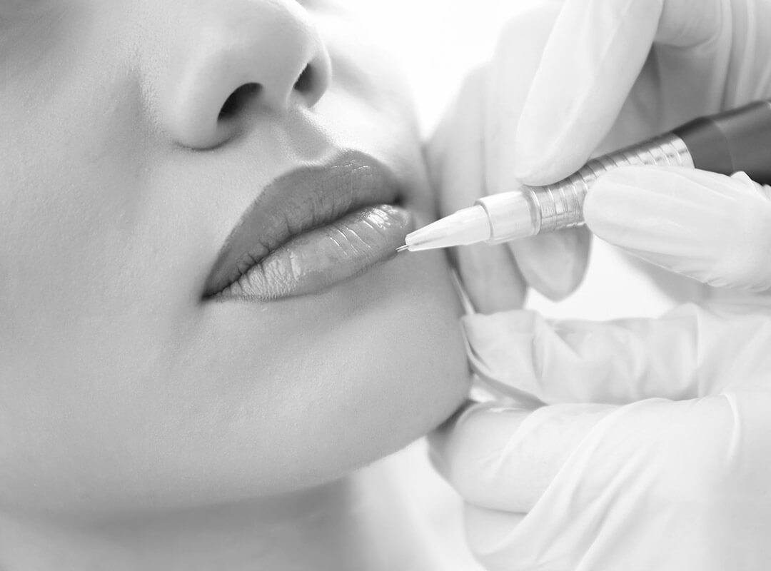 Woman receiving lip micropigmentation treatment to enhance lips colour.