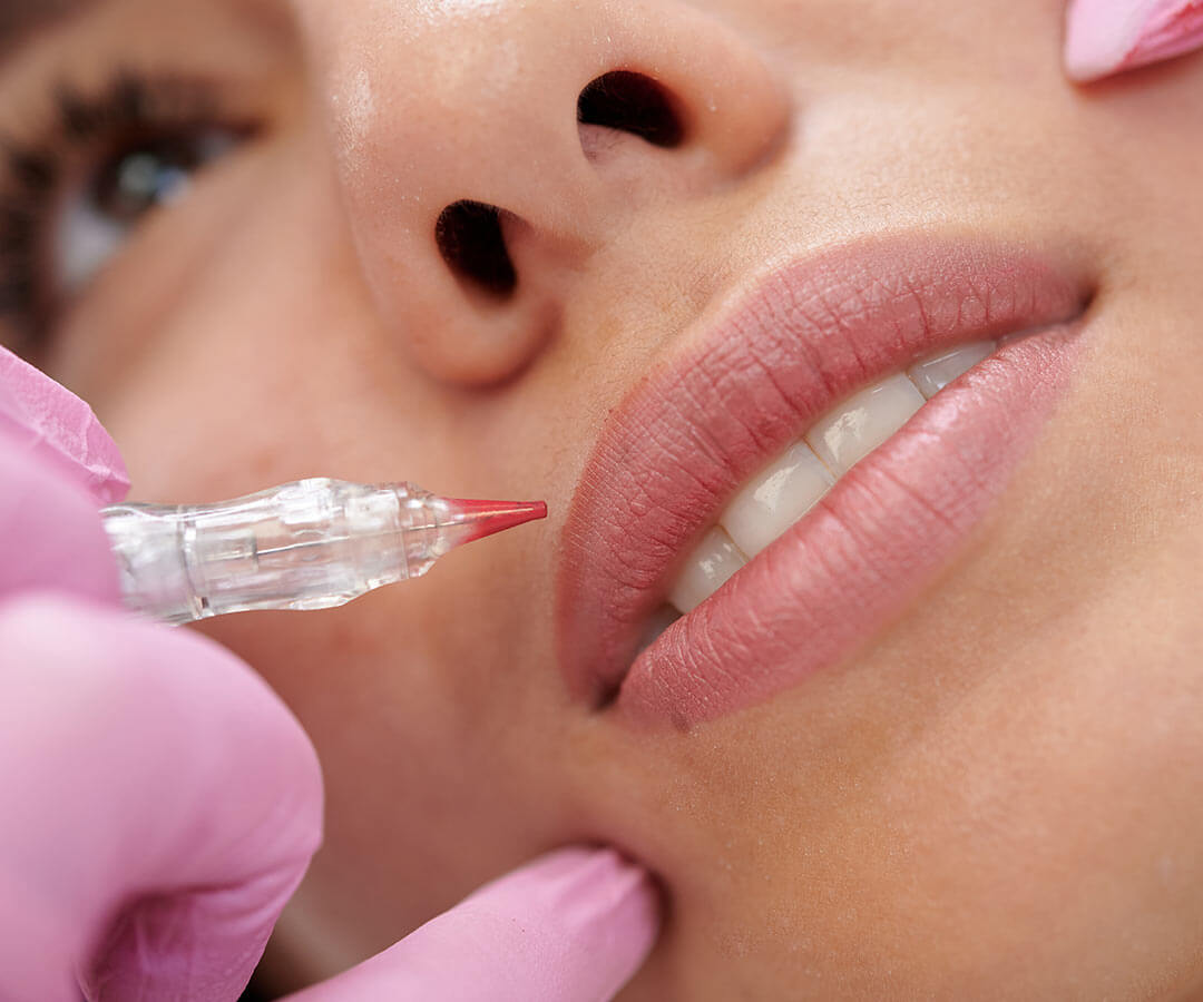 Lip micropigmentation being applied to a woman's lips to enhance the colour.
