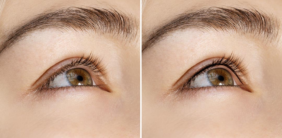 Before and after permanent eye makeup results after lash line enhancement.